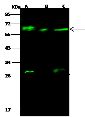 Western Blot: GALNT2 Antibody [NBP3-00188] - NBP3-00188 at 1:500 dilution Lane A: A549 Whole Cell Lysate Lane B: Hela Whole Cell Lysate Lane C: U87MG Whole Cell Lysate Lysates/proteins at 30 ug per lane. Secondary Goat Anti- Rabbit IgG H&L (Dylight 800) at 1/10000 dilution. Developed using the Odyssey technique. Performed under reducing conditions. Predicted band size:65 kDa Observed band size:65 kDa (We are unsure as to the identity of these extra bands.) 