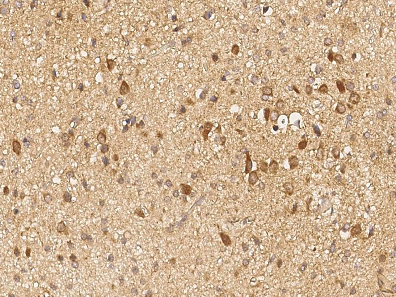Immunohistochemistry-Paraffin: GALNT2 Antibody [NBP3-00188] - Immunochemical staining of human GALNT2 in human brain with NBP3-00188 (1:1000, formalin-fixed paraffin embedded sections).