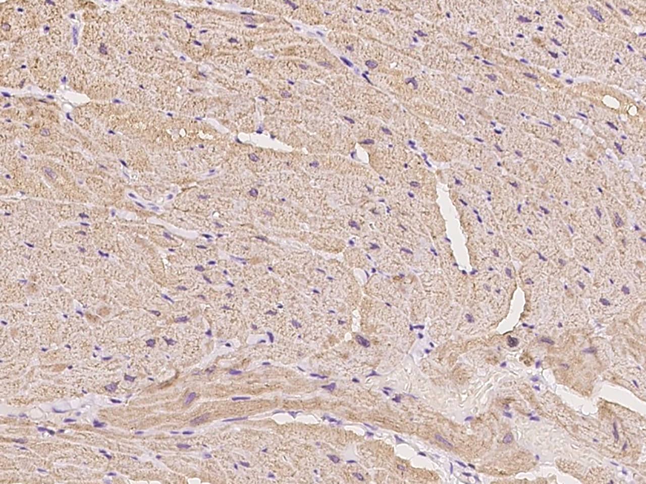 Immunohistochemistry-Paraffin: Calsequestrin 1 Antibody [NBP3-00194] - Immunochemical staining of Calsequestrin 1 in cynomolgus heart with NBP3-00194 at 1:300 dilution, formalin-fixed paraffin embedded sections.