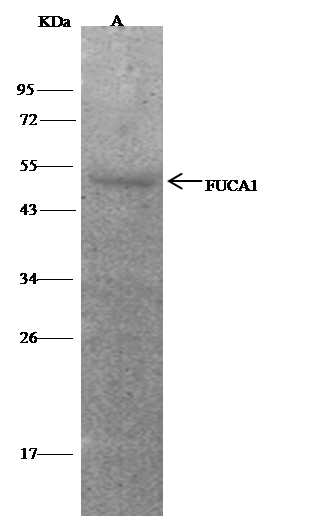 Immunoprecipitation: Tissue alpha-L-Fucosidase/FUCA1 Antibody [NBP3-00209] - FUCA1 was immunoprecipitated using: Lane A:0.5 mg Hela Whole Cell Lysate 1 uL NBP3-00209 and 15 ul of 50 % Protein G agarose. Primary antibody: NBP3-00209, at 1:500 dilution. Secondary antibody: IP Detection Reagent (HRP) at 1:500 dilution. Developed using the DAB staining technique. Performed under reducing conditions. Predicted band size: 54 kDa Observed band size: 54 kDa 