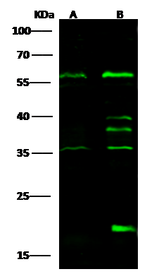 Western Blot: IP6K1 Antibody [NBP3-00228] - NBP3-00228 at 1:500 dilution Lane A: MOLT4 Whole Cell Lysate Lane B: Hela Whole Cell Lysate Lysates/proteins at 30 ug per lane. Secondary Goat Anti-Rabbit IgG H&L (Dylight800) at 1/10000 dilution. Developed using the Odyssey technique. Performed under reducing conditions. Predicted band size:50 kDa Observed band size:56 kDa (We are unsure as to the identity of these extra bands.) 