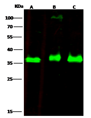 Western Blot: EBAG9/RCAS1 Antibody [NBP3-00242] - NBP3-00242 at 1:500 dilution Lane A: A431 Whole Cell Lysate Lane B: MCF7 Whole Cell Lysate Lane C: THP1 Whole Cell Lysate Lysates/proteins at 30 ug per lane. Secondary Goat Anti-Rabbit IgG H&L (Dylight800) at 1/10000 dilution. Developed using the Odyssey technique. Performed under reducing conditions. Predicted band size:24 kDa Observed band size:37 kDa 
