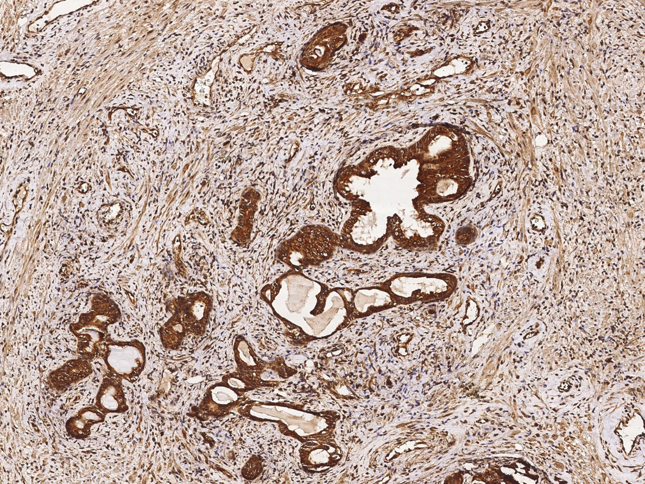 Immunohistochemistry-Paraffin: EBAG9/RCAS1/RCAS1 Antibody [NBP3-00242] - Immunochemical staining of human EBAG9/RCAS1 in human prostate with NBP3-00242 (1:2000, formalin-fixed paraffin embedded sections).