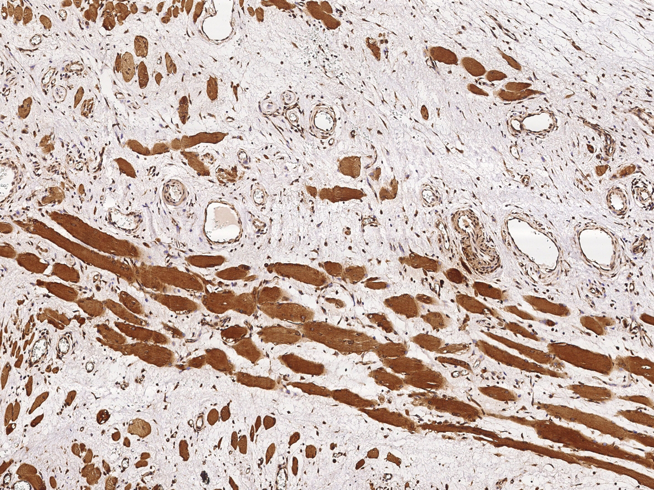 Immunohistochemistry-Paraffin: EBAG9/RCAS1/RCAS1 Antibody [NBP3-00242] - Immunochemical staining of human EBAG9/RCAS1 in human skeletal muscle with NBP3-00242 (1:2000, formalin-fixed paraffin embedded sections).