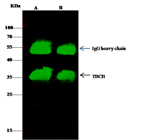 Immunoprecipitation: CKAP1 Antibody [NBP3-00264] - TBCB was immunoprecipitated using: Lane A:0.5 mg Hela Whole Cell Lysate Lane B:0.5 mg HuT78 Whole Cell Lysate 2 uL NBP3-00264 and 15 ul of 50 % Protein G agarose. Primary antibody: NBP3-00264, at 1:200 dilution. Secondary antibody: Dylight 800-labeled antibody to rabbit IgG (H+L), at 1:5000 dilution. Developed using the odssey technique. Performed under reducing conditions. Predicted band size: 35 kDa Observed band size: 35 kDa 