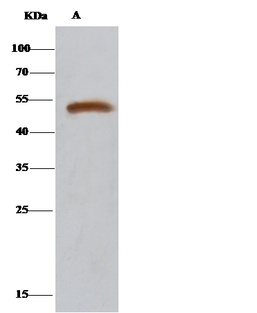 Immunoprecipitation: DARS Antibody [NBP3-00268] - DARS was immunoprecipitated using: Lane A:0.5 mg K562 Whole Cell Lysate 2 uL NBP3-00268 and 15 ul of 50 % Protein G agarose. Primary antibody: NBP3-00268, at 1:100 dilution. Secondary antibody: IP Detection Reagent (HRP) at 1:1000 dilution. Developed using the DAB staining technique. Performed under reducing conditions. Predicted band size: 55 kDa Observed band size: 55 kDa 