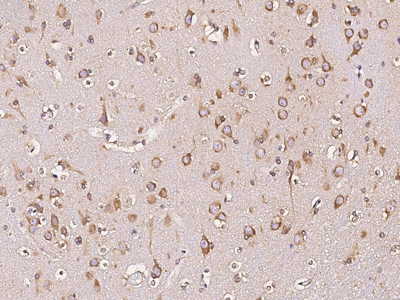Immunohistochemistry-Paraffin: DARS Antibody [NBP3-00268] - Immunochemical staining of human DARS in human brain with NBP3-00268 (1:10000, formalin-fixed paraffin embedded sections).