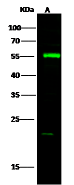 Western Blot: DARS Antibody [NBP3-00268] - NBP3-00268 at 1:500 dilution Lane A: K562 Whole Cell Lysate Lysates/proteins at 30 ug per lane. Secondary Goat Anti-Rabbit IgG H&L (Dylight800) at 1/10000 dilution. Developed using the Odyssey technique. Performed under reducing conditions. Predicted band size:57 kDa Observed band size:55 kDa (We are unsure as to the identity of these extra bands.) 