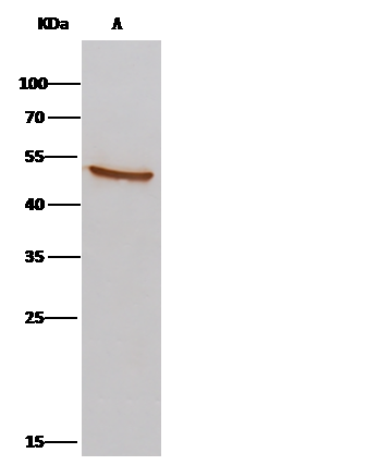 Immunoprecipitation: AARSD1 Antibody [NBP3-00270] - AARSD1 was immunoprecipitated using: Lane A:0.5 mg Hela Whole Cell Lysate 2 uL NBP3-00270 and 15 ul of 50 % Protein G agarose. Primary antibody: NBP3-00270, at 1:100 dilution. Secondary antibody: IP Detection Reagent (HRP) at 1:1000 dilution. Developed using the DAB staining technique. Performed under reducing conditions. Predicted band size: 45 kDa Observed band size: 45 kDa 
