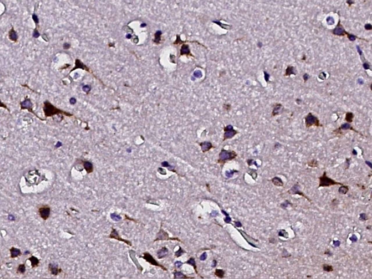 Immunohistochemistry-Paraffin: PTS Antibody [NBP3-00276] - Immunochemical staining of human PTS in human brain with NBP3-00276 (1:2000, formalin-fixed paraffin embedded sections).
