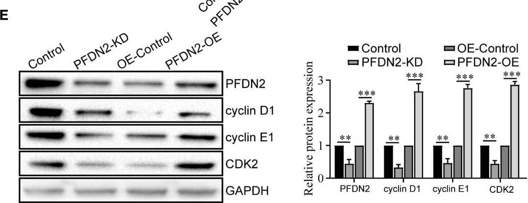 PFDN2 promotes cell cycle progression in GC cells. (A) Bubble chart showing Gene Ontology (GO) enrichment analysis of the RNA-sequencing (RNA-seq) data from PFDN2-KD and HGC27-NC cells. (B) GSEA of the RNA-sequencing (RNA-seq) data from PFDN2-KD and HGC27-NC cells. (C) Flow cytometry was used to analyze the cell cycle in HGC27-NC and PFDN2-KD cell lines and in MKN45-NC and PFDN2-OE cell lines. (D) Cell proliferation abilities were determined by EdU staining in HGC27-NC and PFDN2-KD cell lines and in MKN45-NC and PFDN2-OE cell lines. (E) WB analysis of PFDN2, cyclin D1, cyclin E1 and CDK2 in HGC27-NC and PFDN2-KD cell lines and in MKN45-NC and PFDN2-OE cell lines. The protein levels were quantified with ImageJ. **p < 0.01; ***p < 0.001. Image collected and cropped by CiteAb from the following open publication (//www.frontiersin.org/articles/10.3389/fonc.2023.1164070/full), licensed under a CC-BY license. Not internally tested by Novus Biologicals.