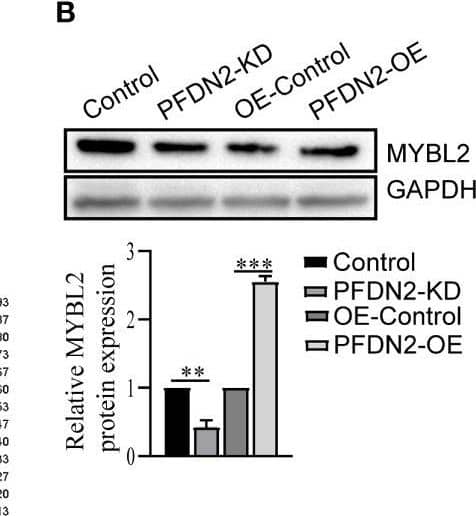 PFDN2 promotes cell cycle progression through regulating MYBL2 expression. (A) Heatmap presenting significantly differentially expressed transcripts between HGC27-NC and PFDN2-KD cell lines. (B) WB analysis of MYBL2 in HGC27-NC and PFDN2-KD cell lines. (C) The correlation of PFDN2 expression with MYBL2 expressions in GC tissues from TCGA. (D) Flow cytometry was used to analyze the cell cycle in HGC27-NC and PFDN2-KD cell lines treated with MYBL2 OE or NC and in MKN45-NC and PFDN2-OE cell lines treated with MYBL2 KD or NC. (E) Cell proliferation abilities were determined by EdU staining in HGC27-NC and PFDN2-KD cell lines treated with MYBL2 OE or NC and in MKN45-NC and PFDN2-OE cell lines treated with MYBL2 KD or NC. (F) WB analysis of PFDN2, cyclin D1, cyclin E1 and CDK2 in HGC27-NC and PFDN2-KD cell lines treated with MYBL2 OE or NC and in MKN45-NC and PFDN2-OE cell lines treated with MYBL2 KD or NC. **p < 0.01; ***p < 0.001. Image collected and cropped by CiteAb from the following open publication (//www.frontiersin.org/articles/10.3389/fonc.2023.1164070/full), licensed under a CC-BY license. Not internally tested by Novus Biologicals.