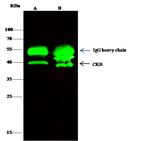Immunoprecipitation: Creatine Kinase BB Antibody [NBP3-00288] - CKB was immunoprecipitated using: Lane A:0.5 mg A431 Whole Cell Lysate Lane B:0.5 mg Hela Whole Cell Lysate 2 uL NBP3-00288 and 15 ul of 50 % Protein G agarose. Primary antibody: NBP3-00288, at 1:200 dilution. Secondary antibody: Dylight 800-labeled antibody to rabbit IgG (H+L), at 1:5000 dilution. Developed using the odssey technique. Performed under reducing conditions. Predicted band size: 43 kDa Observed band size: 43 kDa 