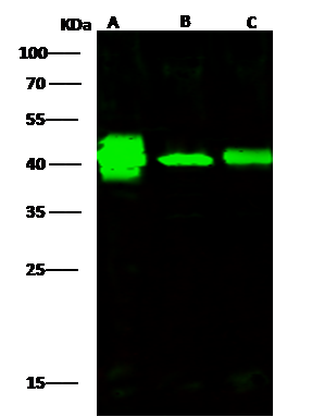 Western Blot: Creatine Kinase BB Antibody [NBP3-00288] - NBP3-00288 at 1:500 dilution Lane A: Jurkat Whole Cell Lysate Lane B: Hela Whole Cell Lysate Lane C: A431 Whole Cell Lysate Lysates/proteins at 30 ug per lane. Secondary Goat Anti-Rabbit IgG H&L (Dylight800) at 1/10000 dilution. Developed using the Odyssey technique. Performed under reducing conditions. Predicted band size:43 kDa Observed band size:43 kDa 