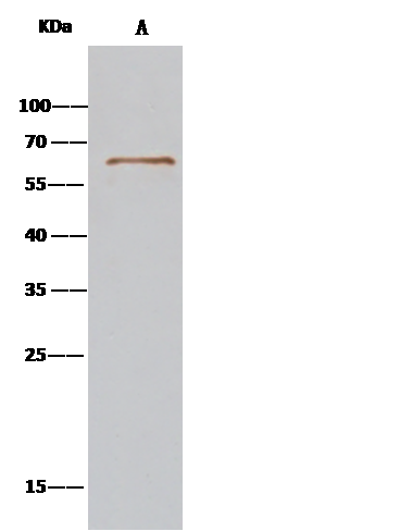 Immunoprecipitation: SRFBP1 Antibody [NBP3-00297] - SRFBP1 was immunoprecipitated using: Lane A:0.5 mg HepG2 Whole Cell Lysate 2 uL NBP3-00297 and 15 ul of 50 % Protein G agarose. Primary antibody: NBP3-00297, at 1:100 dilution. Secondary antibody: IP Detection Reagent (HRP) at 1:1000 dilution. Developed using the DAB staining technique. Performed under reducing conditions. Predicted band size: 47 kDa Observed band size: 68 kDa 