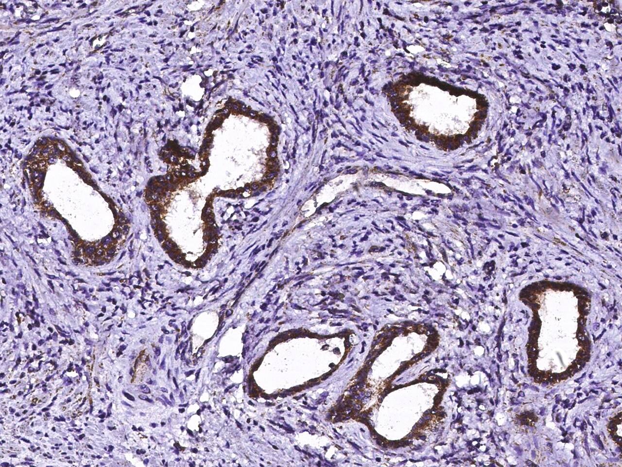 Immunohistochemistry-Paraffin: ECH1 Antibody [NBP3-00324] - Immunochemical staining of human ECH1 in human prostate with NBP3-00324 (1:10000, formalin-fixed paraffin embedded sections).