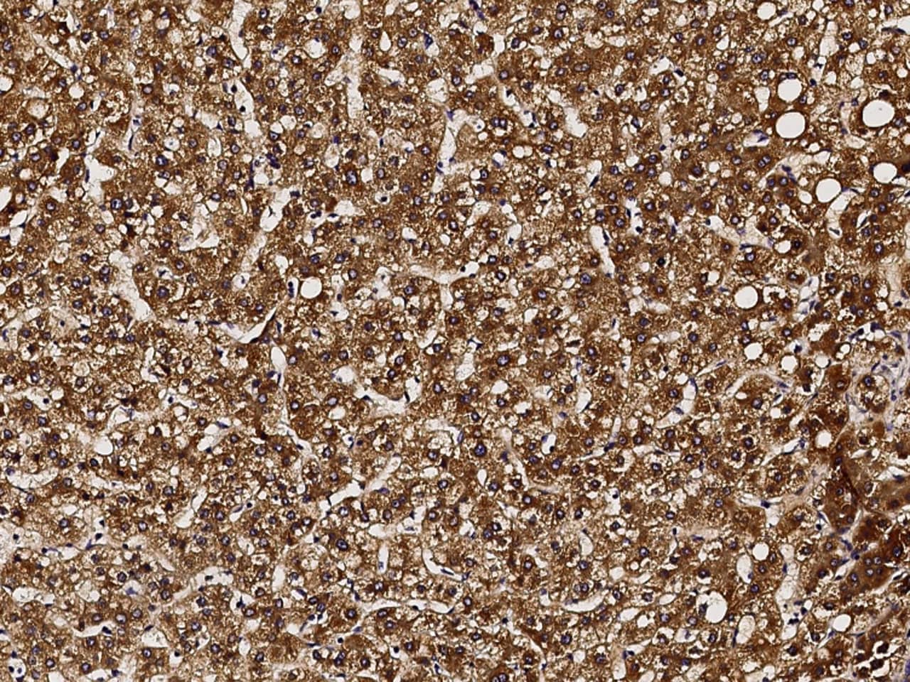 Immunohistochemistry-Paraffin: GCSH Antibody [NBP3-00326] - Immunochemical staining of human GCSH in human liver with NBP3-00326 (1:1000, formalin-fixed paraffin embedded sections).