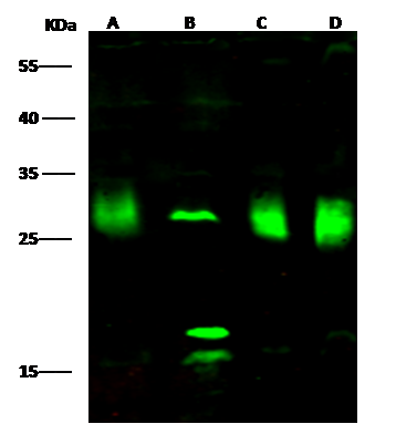 Western Blot: PMM2/Phosphomannomutase 2 Antibody [NBP3-00351] - NBP3-00351 at 1:500 dilution Lane A: Hela Whole Cell Lysate Lane B: K562 Whole Cell Lysate Lane C: MCF7 Whole Cell Lysate Lane D: HepG2 Whole Cell Lysate Lysates/proteins at 30 ug per lane. Secondary Goat Anti-Rabbit IgG H&L (Dylight800) at 1/10000 dilution. Developed using the Odyssey technique. Performed under reducing conditions. Predicted band size:28 kDa Observed band size:28 kDa (We are unsure as to the identity of these extra bands.) 