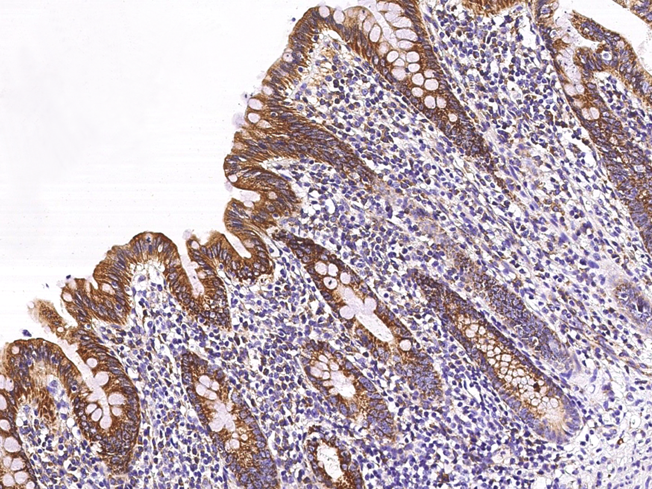 Immunohistochemistry-Paraffin: ETHE1 Antibody [NBP3-00355] - Immunochemical staining of human ETHE1 in human appendix with NBP3-00355 (1:10000, formalin-fixed paraffin embedded sections).