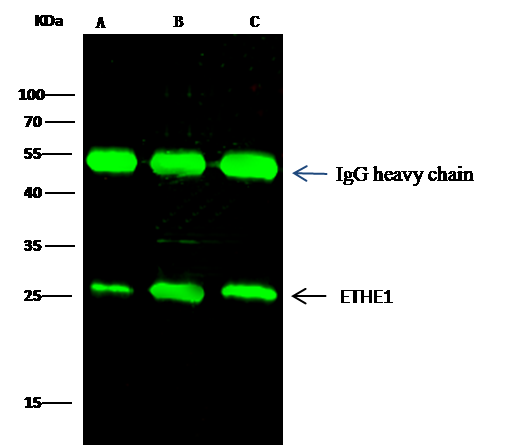 Immunoprecipitation: ETHE1 Antibody [NBP3-00355] - ETHE1 was immunoprecipitated using: Lane A:0.5 mg Hela Whole Cell Lysate Lane B:0.5 mg HepG2 Whole Cell Lysate Lane C:0.5 mg Jurkat Whole Cell Lysate 2 uL NBP3-00355 and 15 ul of 50 % Protein G agarose. Primary antibody: NBP3-00355, at 1:100 dilution. Secondary antibody: Dylight 800-labeled antibody to rabbit IgG (H+L), at 1:5000 dilution. Developed using the odssey technique. Performed under reducing conditions. Predicted band size: 28 kDa Observed band size: 28 kDa 