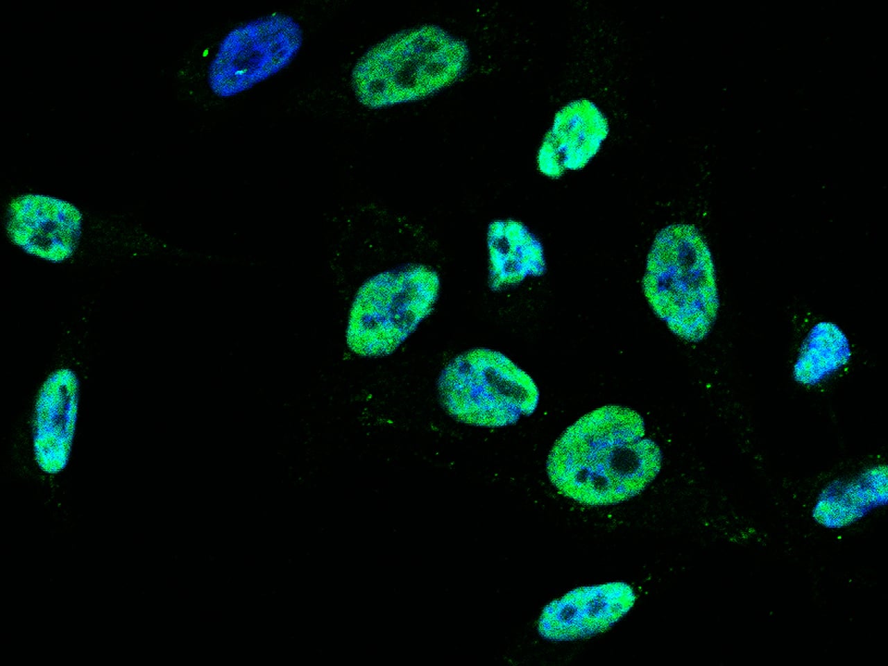 Immunocytochemistry/ Immunofluorescence: PA28 Activator gamma Subunit/PSME3 Antibody [NBP3-00356] - Immunofluorescence staining of PA28 Activator gamma Subunit/PSME3 in HeLa cells. Cells were fixed with 4% PFA, permeabilzed with 0.3% Triton X-100 in PBS,blocked with 10% serum, and incubated with NBP3-00356 (dilution ratio 1:1000) at 4 overnight. Then cells were stained with the Alexa Fluor488-conjugated Goat Anti-rabbit IgG secondary antibody (green) and counterstained with DAPI (blue). Positive staining was localized to nucleus.