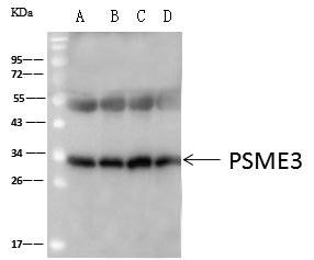 Immunoprecipitation: PA28 Activator gamma Subunit/PSME3 Antibody [NBP3-00357] - PSME3 was immunoprecipitated using:  Lane A:0.5 mg Jurkat Whole Cell Lysate  Lane B:0.5 mg A-431 Whole Cell Lysate  Lane C:0.5 mg MCF7 Whole Cell Lysate  Lane D:0.5 mg HepG2 Whole Cell Lysate 4uL NBP3-00357 and 60 ug of Immunomagnetic beads Protein A/G. Primary antibody:  NBP3-00357, at 1:100 dilution     Secondary antibody:  Goat Anti-Rabbit IgG (H+L)[HRP] at 1/10000 dilution. Developed using the ECL technique. Performed under reducing conditions. Predicted band size: 29 kDa Observed band size :34 kDa 