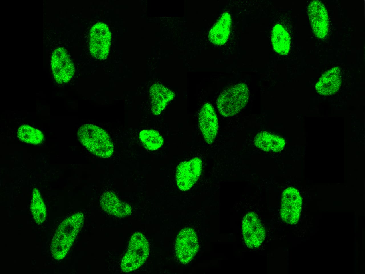Immunocytochemistry/ Immunofluorescence: PA28 Activator gamma Subunit/PSME3 Antibody [NBP3-00357] - Immunofluorescence staining of PA28 Activator gamma Subunit/PSME3 in HeLa cells. Cells were fixed with 4% PFA, permeabilzed with 0.1% Triton X-100 in PBS,blocked with 10% serum, and incubated with NBP3-00357 (dilution ratio 1:300) at 4 overnight. Then cells were stained with the Alexa Fluor$488-conjugated Goat Anti-rabbit IgG secondary antibody (green). Positive staining was localized to nucleus.