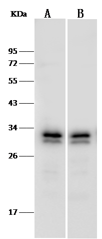 Western Blot: PA28 Activator gamma Subunit/PSME3 Antibody [NBP3-00357] - NBP3-00357 at 1:500 dilution Lane A: Jurkat Whole Cell Lysate Lane B: HepG2 Whole Cell Lysate Lysates/proteins at 30 ug per lane. Secondary Goat Anti-Rabbit IgG (H+L)/HRP at 1/10000 dilution. Developed using the ECL technique. Performed under reducing conditions. Predicted band size:29 kDa Observed band size:30 kDa 