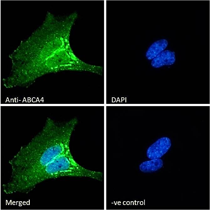 Immunocytochemistry/Immunofluorescence: ABCA4 Antibody [NBP3-00524] - Immunofluorescence analysis of paraformaldehyde fixed HeLa cells, permeabilized with 0.15% Triton. Primary incubation 1hr (10ug/ml) followed by Alexa Fluor 488 secondary antibody (2ug/ml), showing endoplasmic reticulum staining. The nuclear stain is DAPI (blue). Negative control: Unimmunized goat IgG (10ug/ml) followed by Alexa Fluor 488 secondary antibody (2ug/ml).