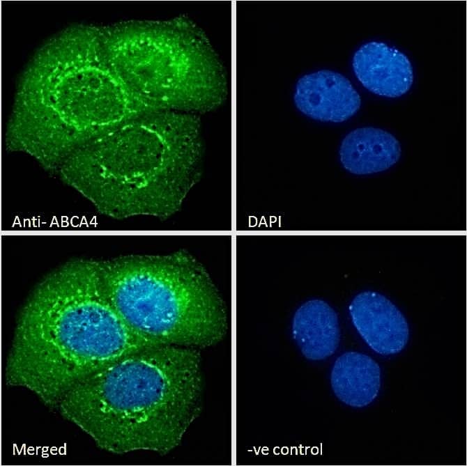 Immunocytochemistry/Immunofluorescence: ABCA4 Antibody [NBP3-00524] - Immunofluorescence analysis of paraformaldehyde fixed MCF7 cells, permeabilized with 0.15% Triton. Primary incubation 1hr (10ug/ml) followed by Alexa Fluor 488 secondary antibody (2ug/ml), showing endoplasmic reticulum staining. The nuclear stain is DAPI (blue). Negative control: Unimmunized goat IgG (10ug/ml) followed by Alexa Fluor 488 secondary antibody (2ug/ml).