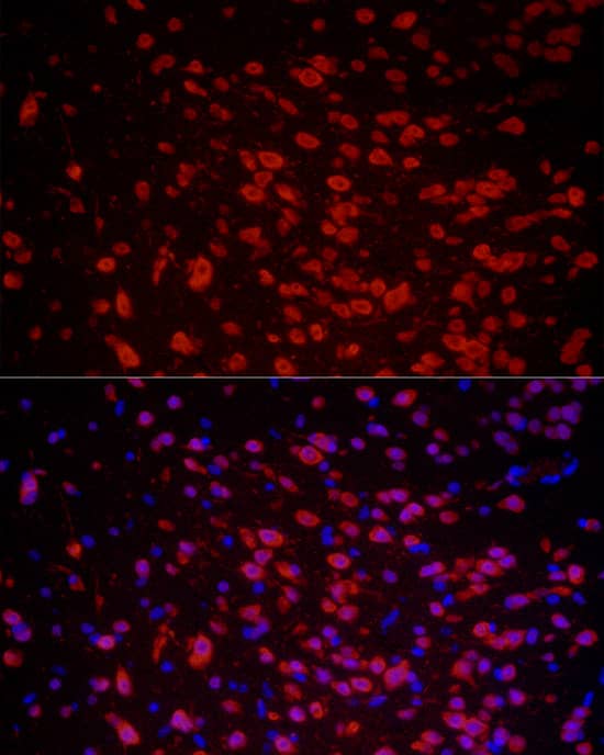 Immunocytochemistry/ Immunofluorescence: HuC Antibody - Azide and BSA Free [HuC] - Immunofluorescence analysis of paraffin-embedded mouse brain using HuC Rabbit pAb  at dilution of 1:50 (40x lens). Secondary antibody: Cy3-conjugated Goat anti-Rabbit IgG (H+L)  at 1:500 dilution. Blue: DAPI for nuclear staining.