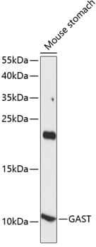 Western Blot: Gastrin Antibody - Azide and BSA Free [NBP3-02945] - Western blot analysis of lysates from mouse stomach, using Gastrin Rabbit pAb (A14571) at 1:1000 dilution.Secondary antibody: HRP Goat Anti-Rabbit IgG (H+L) (AS014) at 1:10000 dilution.Lysates/proteins: 25μg per lane.Blocking buffer: 3% nonfat dry milk in TBST.Detection: ECL Basic Kit (RM00020).Exposure time: 90s.