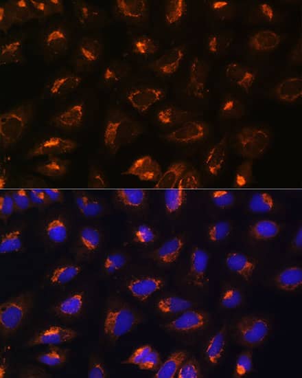 Immunocytochemistry/ Immunofluorescence: MEK2 Antibody - Azide and BSA Free [NBP3-02952] - Immunofluorescence analysis of U2OS cells using [KO Validated] MEK2 Rabbit pAb (A14770) at dilution of 1:100. Blue: DAPI for nuclear staining.