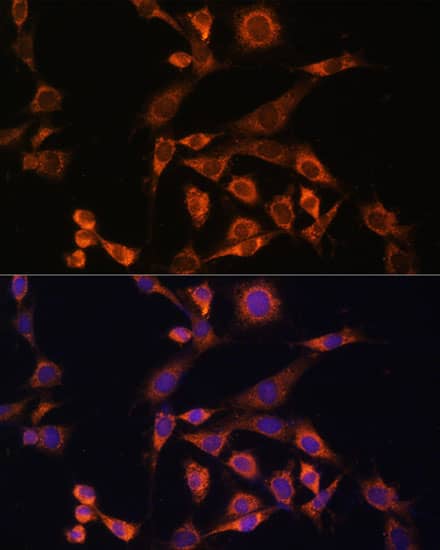 Immunocytochemistry/ Immunofluorescence: MEK2 Antibody - Azide and BSA Free [NBP3-02952] - Immunofluorescence analysis of NIH/3T3 cells using [KO Validated] MEK2 Rabbit pAb (A14770) at dilution of 1:100. Blue: DAPI for nuclear staining.