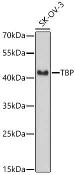 Western Blot: TATA binding protein TBP Antibody - BSA Free [NBP3-02958] - Western blot analysis of lysates from SK-OV-3 cells using TATA binding protein TBP Rabbit pAb(A2192) at 1:1000 dilution.Secondary antibody:HRP Goat Anti-Rabbit IgG (H+L)(AS014) at 1:10000 dilution.Lysates/proteins: 25 μg per lane.Blocking buffer: 3% nonfat dry milk in TBST.Detection:ECL Basic Kit (RM00020).Exposuretime:3s.