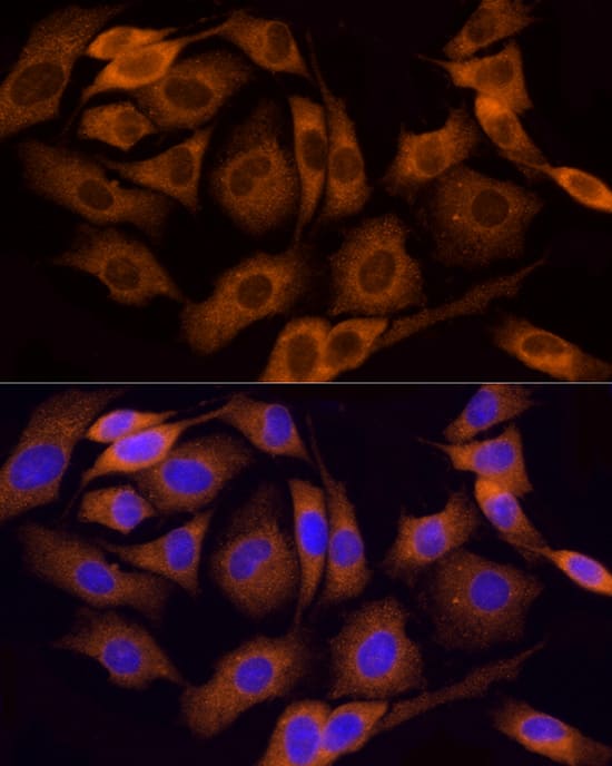 Immunocytochemistry/ Immunofluorescence: Tumstatin/COL4A3 Antibody - Azide and BSA Free [NBP3-02967] - Immunofluorescence analysis of PC-12 cells using Tumstatin/COL4A3 Rabbit pAb (A16359) at dilution of 1:100 (40x lens). Blue: DAPI for nuclear staining.