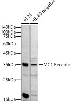 Western Blot: Melanocortin-1 R/MC1R Antibody - Azide and BSA Free [Melanocortin-1 R/MC1R] - Western blot analysis of various lysates using Melanocortin-1 R/MC1R Rabbit pAb  at  1:1000 dilution.Secondary antibody: HRP-conjugated Goat anti-Rabbit IgG (H+L)  at 1:10000 dilution.Lysates/proteins: 25ug per lane.Blocking buffer: 3% nonfat dry milk in TBST.Detection: ECL Basic Kit .Exposure time: 60s.