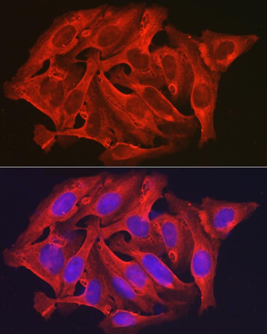 Immunocytochemistry/ Immunofluorescence: DAP Kinase 2 Antibody - Azide and BSA Free [NBP3-02982] - Immunofluorescence analysis of U2OS cells using DAP Kinase 2 Rabbit pAb (A8199) at dilution of 1:200 (40x lens). Blue: DAPI for nuclear staining.