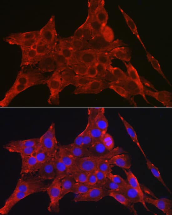 Immunocytochemistry/ Immunofluorescence: DAP Kinase 2 Antibody - Azide and BSA Free [NBP3-02982] - Immunofluorescence analysis of PC-12 cells using DAP Kinase 2 Rabbit pAb (A8199) at dilution of 1:200 (40x lens). Blue: DAPI for nuclear staining.