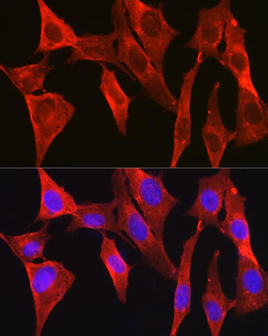 Immunocytochemistry/ Immunofluorescence: DAP Kinase 2 Antibody - Azide and BSA Free [NBP3-02982] - Immunofluorescence analysis of NIH/3T3 cells using DAP Kinase 2 Rabbit pAb (A8199) at dilution of 1:200 (40x lens). Blue: DAPI for nuclear staining.