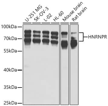Western Blot: hnRNP-R Antibody - BSA Free [NBP3-02996] - Western blot analysis of various lysates using hnRNP-R Rabbit pAb (A5883) at 1:1000 dilution. Secondary antibody: HRP Goat Anti-Rabbit IgG (H+L) (AS014) at 1:10000 dilution. Lysates / proteins: 25 μg per lane. Blocking buffer: 3 % nonfat dry milk in TBST. Detection: ECL Basic Kit (RM00020). Exposure time: 1s.