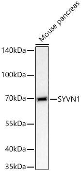 Western Blot: HRD1 Antibody - BSA Free [HRD1] - Western blot analysis of lysates from Mouse pancreas using HRD1 Rabbit pAb  at 1:3000 dilution incubated overnight at 4C.Secondary antibody: HRP-conjugated Goat anti-Rabbit IgG (H+L)  at 1:10000 dilution.Lysates/proteins: 25 ug per lane.Blocking buffer: 3% nonfat dry milk in TBST.Detection: ECL Basic Kit .Exposure time: 20s.