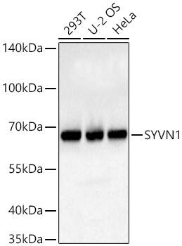 Western Blot: HRD1 Antibody - BSA Free [HRD1] - Western blot analysis of various lysates using HRD1 Rabbit pAb  at 1:3000 dilution incubated overnight at 4C.Secondary antibody: HRP-conjugated Goat anti-Rabbit IgG (H+L)  at 1:10000 dilution.Lysates/proteins: 25 ug per lane.Blocking buffer: 3% nonfat dry milk in TBST.Detection: ECL Basic Kit .Exposure time: 1s.