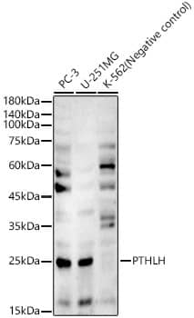 Western Blot: PTHLH/PTHrP Antibody - BSA Free [NBP3-03168] - Western blot analysis of various lysates, using PTHLH/PTHrP Rabbit pAb (A3183) at 1:8000 dilution.Secondary antibody: HRP Goat Anti-Rabbit IgG (H+L) (AS014) at 1:10000 dilution.Lysates/proteins: 25μg per lane.Blocking buffer: 3% nonfat dry milk in TBST.Detection: ECL Basic Kit (RM00020).Exposure time: 90s.