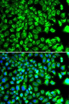Immunocytochemistry/ Immunofluorescence: BORCS7 Antibody - BSA Free [NBP3-03231] - Immunofluorescence analysis of MCF-7 cells using BORCS7 antibody (A7276). Blue: DAPI for nuclear staining.
