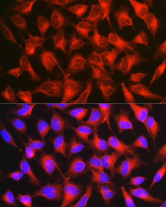 Immunocytochemistry/ Immunofluorescence: L1CAM Antibody - BSA Free [NBP3-03276] - Immunofluorescence analysis of HeLa cells using L1CAM Rabbit pAb (A8555) at dilution of 1:100 (40x lens). Blue: DAPI for nuclear staining.