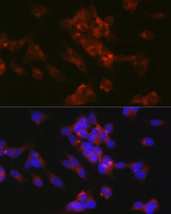 Immunocytochemistry/ Immunofluorescence: L1CAM Antibody - BSA Free [NBP3-03276] - Immunofluorescence analysis of SH-SY5Y cells using L1CAM Rabbit pAb (A8555) at dilution of 1:100 (40x lens). Blue: DAPI for nuclear staining.