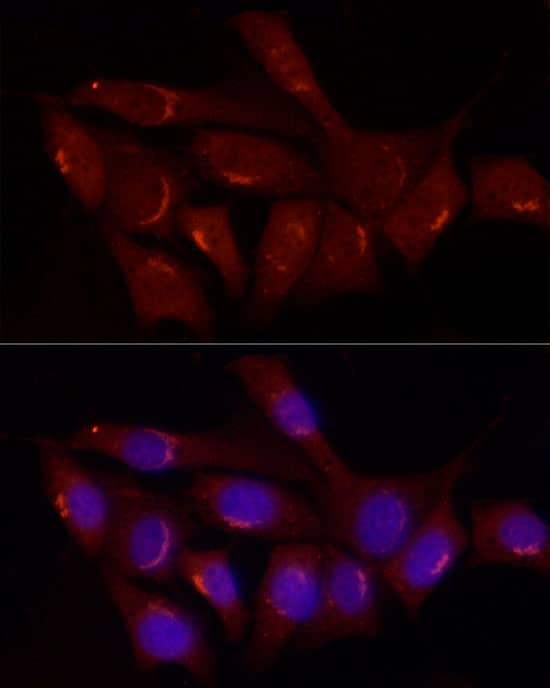 Immunocytochemistry/ Immunofluorescence: Gastrin-releasing Peptide/Bombesin/Neuromedin C Antibody - BSA Free [Gastrin-releasing Peptide/Bombesin/Neuromedin C] - Immunofluorescence analysis of NIH/3T3 cells using Gastrin-releasing Peptide/Bombesin/Neuromedin C Rabbit pAb  at dilution of 1:50 (40x lens). Secondary antibody: Cy3 Goat Anti-Rabbit IgG (H+L)  at 1:500 dilution. Blue: DAPI for nuclear staining.