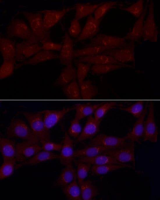 Immunocytochemistry/ Immunofluorescence: Gastrin-releasing Peptide/Bombesin/Neuromedin C Antibody - BSA Free [Gastrin-releasing Peptide/Bombesin/Neuromedin C] - Immunofluorescence analysis of PC-12 cells using Gastrin-releasing Peptide/Bombesin/Neuromedin C Rabbit pAb  at dilution of 1:50 (40x lens). Secondary antibody: Cy3 Goat Anti-Rabbit IgG (H+L)  at 1:500 dilution. Blue: DAPI for nuclear staining.