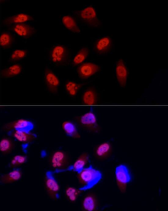 <b>Genetic Strategies Validation. </b>Immunocytochemistry/ Immunofluorescence: Methyltransferase like 3 Antibody - Azide and BSA Free [Methyltransferase like 3] - Immunofluorescence analysis of PC-3 cells using Methyltransferase like 3 Rabbit pAb  at dilution of 1:100 (40x lens). Secondary antibody: Cy3-conjugated Goat anti-Rabbit IgG (H+L)  at 1:500 dilution. Blue: DAPI for nuclear staining.